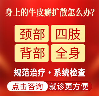 银屑病背部严重怎么回事